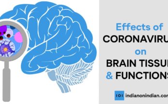 Effects of Coronavirus on Brain Tissue and Functions